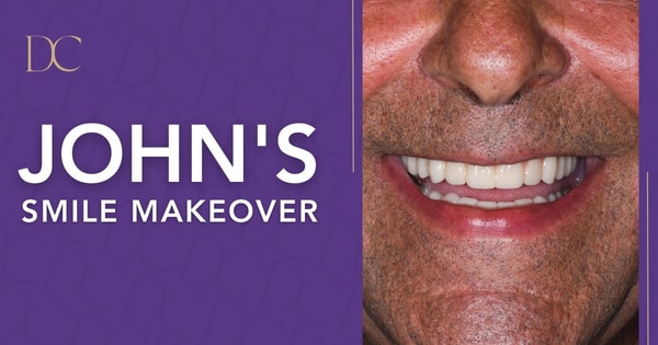 John’s Dental Implant Journey in Melbourne