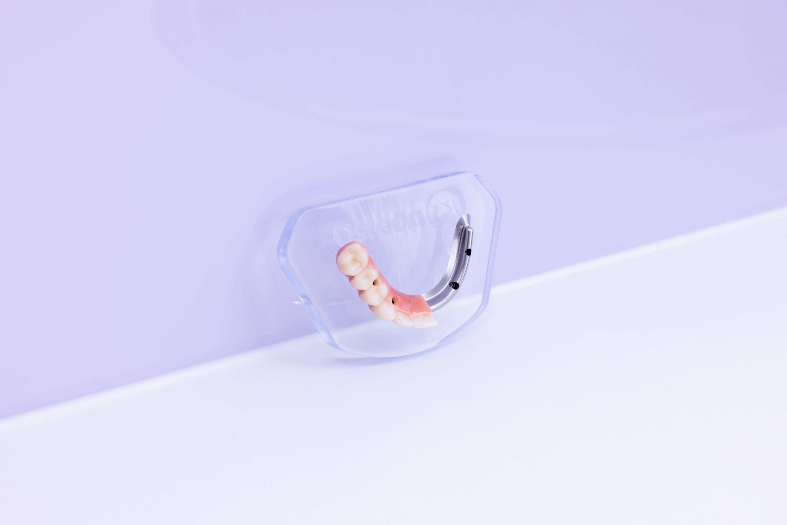 Implant Bridge in Dental Couture Melbourne