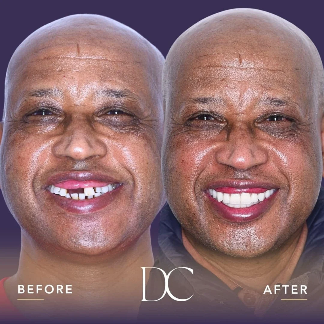David of Wildwood's AO4 Smile Journey in Dental Couture