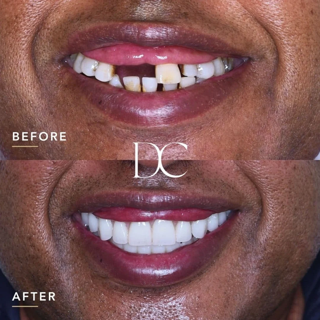 David of Wildwood's AO4 Smile Journey in_Dental Couture