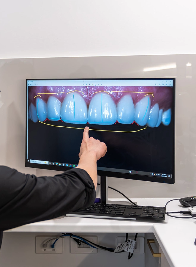 Digital Smile Design Dental Couture