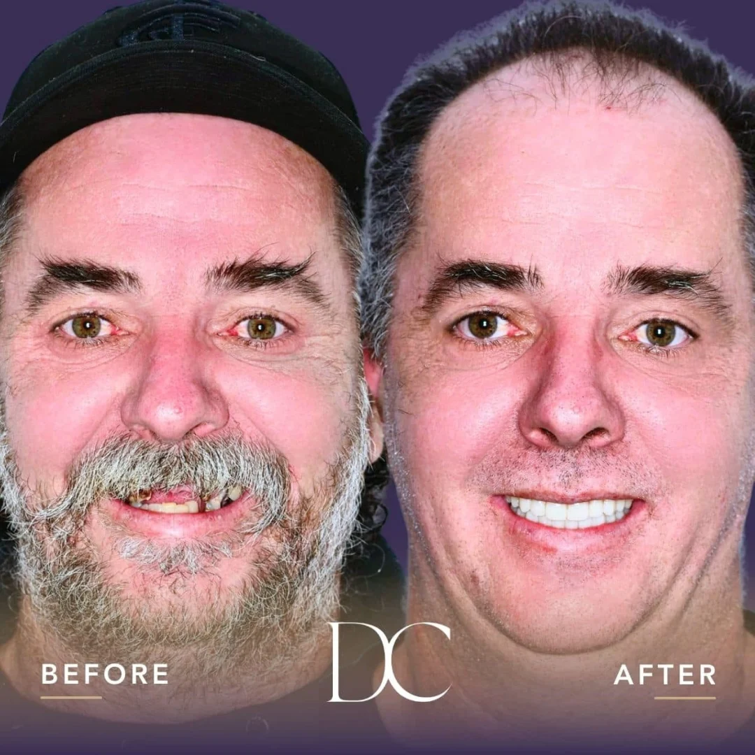 John of Sunbury's A04 Smile Journey in Dental Couture